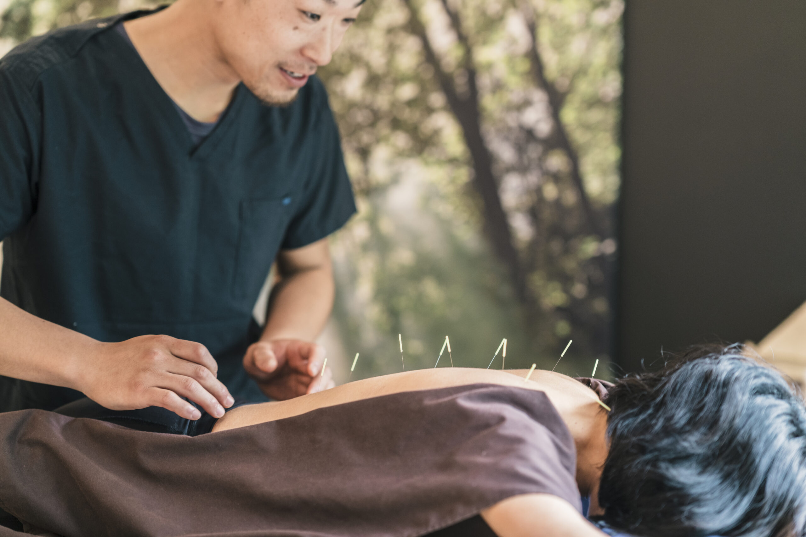 The Benefits of Acupuncture for Pain Management